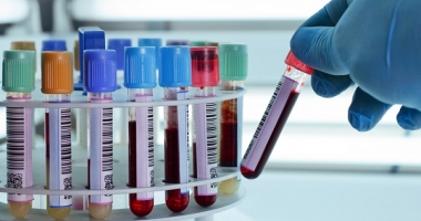 Stire din Sănătate : Bolile transmisibile, raportate de laboratoarele de analize