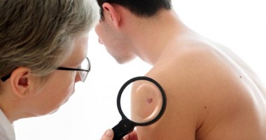 Stire din Sănătate : Psoriazis, boala care face mai multe victime decât cancerul