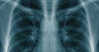 Stire din Sănătate : Peste jumătate din populație prezintă risc de boli pulmonare