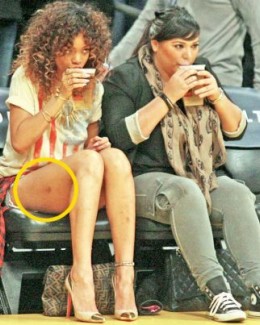 Rihanna, vânătă și obosită - 2