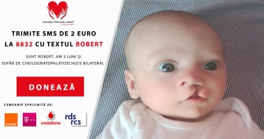 Stire din Sănătate : Ajută-l pe Robert să zâmbească! S-a născut cu o anomalie gravă a gurii