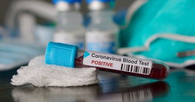 Stire din Eveniment : Încă noi 10 cazuri de infectare cu virusul Covid-19! Cifra bolnavilor crește cu repeziciune, în România
