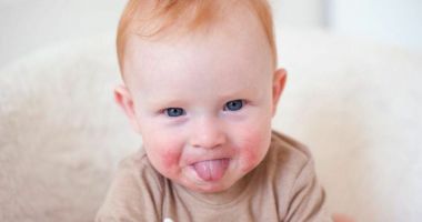 Stire din Sănătate : Roșeala la bebeluși, o afecțiune inofensivă, dar contagioasă