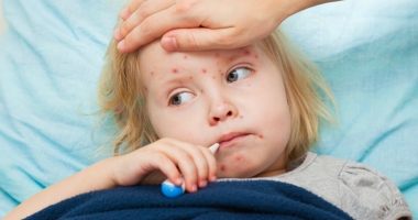 Stire din Sănătate : Vaccinarea împotriva rujeolei. "Fără imunizare, copiii sunt condamnați la moarte"