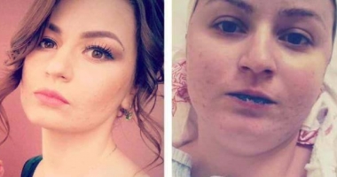 "Cancerul îmi mistuie puterile! Viața mea e pe muchie de cuțit!" NU RĂMÂNEȚI INDIFERENȚI! HAIDEȚI SĂ SALVĂM VIAȚA ACESTEI FETE - 2