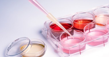 Stire din Sănătate : Invenție medicală românească, premiată cu aur