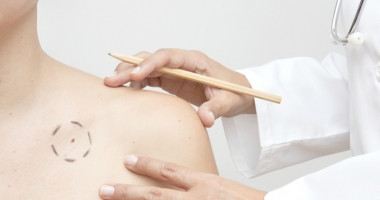 Stire din Sănătate : Semnele alarmante în detecția celui mai frecvent cancer de piele