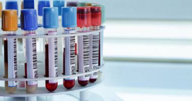 Stire din Sănătate : Se reiau testările gratuite pentru HIV și hepatită  în Spitalul Județean