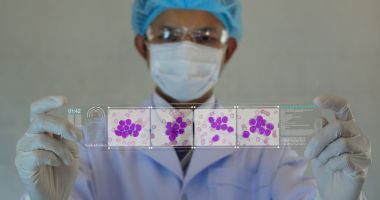 9 factori de risc pentru leucemie