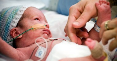 Stire din Sănătate : Situație alarmantă: bugetul pentru prematuri, redus la jumătate