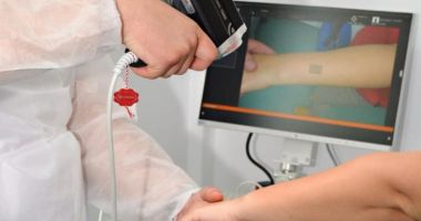Stire din Social : Spital din Galați, dotat cu un aparat unic în România care descoperă cancerul de piele