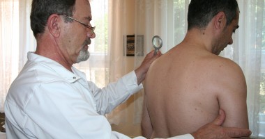Stire din Sănătate : Campanie de informare asupra psoriazisului, la Constanța