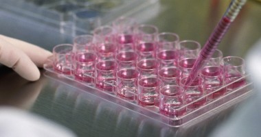 Stire din Sănătate : Cum puteți dona celule stem pentru a salva vieți