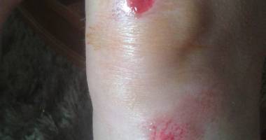 Femeie atacată în plină stradă. Avea 4.000 lei în poșeta - 2