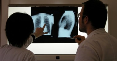 Stire din Sănătate : România are cel mai mare număr de cazuri de TBC din UE