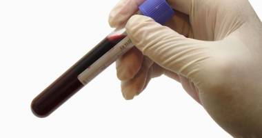 Stire din Sănătate : Te-ai testat pentru hepatită?