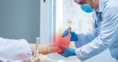 Stire din Sănătate : Efectele terapiei cu plasmă bogată în trombocite