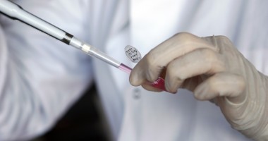 Stire din Cetățenești : Când trebuie făcut  Testul Papanicolau