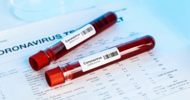 Număr record de infecţii cu SARS-CoV-2 de la începutul pandemiei în Israel