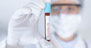Coronavirus în România . Peste 13000 de noi cazuri de români infectați în 24 de ore / 415 decese
