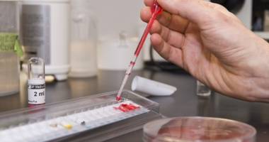 Stire din Sănătate : Testări gratuite pentru hepatita C