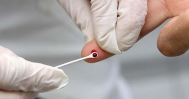 Stire din Sănătate : Până la 18 ani, testarea pentru HIV se face doar cu acordul părinților