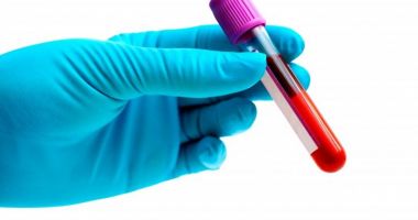 Stire din Actualitate : Preşedinte diagnosticat cu cancer de sânge! Boala, asimptomatică până la 60 de ani