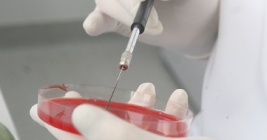 Testul Babeș Papanicolau gratuit pentru constănțence - 2