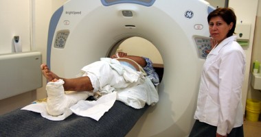 Stire din Sănătate : Macroadenoamele hipofizare,  cele mai frecvente  tumori intracraniene