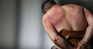 Stire din Social : Astăzi se sărbătoreşte Ziua internaţională pentru sprijinirea victimelor torturii