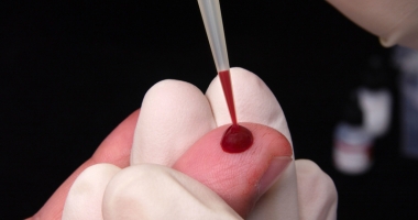 Tratamentul precoce  a infecției cu HIV  este cea mai bună metodă de prevenire
