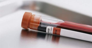 Stire din Sănătate : MS acordă suficiente fonduri pentru tratamentele pentru HIV