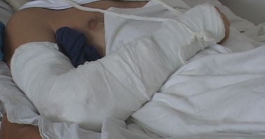 Stire din Sănătate : Plăgile tăiate cu flexul, tot mai frecvente