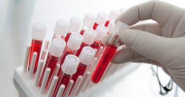 Stire din Sănătate : Adrian Streinu-Cercel: "34.000 români vor fi testați gratuit pentru HIV, hepatita B și C"