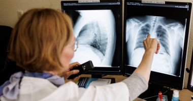 Stire din Social : Institutul "Marius Nasta": Există o legătură între poluare şi tuberculoză