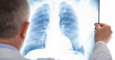 Tuberculoza - cum se manifestă și cum se răspândește boala
