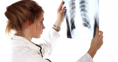 Tuberculoza, boala care face ravagii în organism