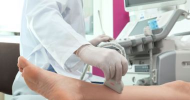 Stire din Sănătate : Când este recomandată ultrasonografia vasculară
