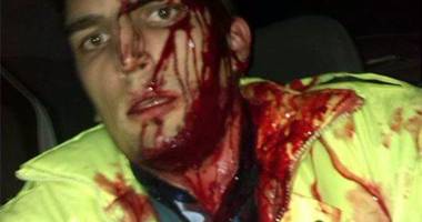 Stire din Eveniment : De ce au ajuns polițiștii ciuca bătăilor: "Le este frică să folosească arma"