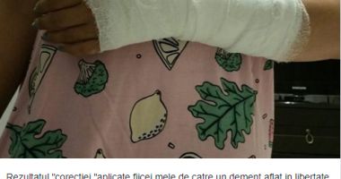 Stire din Eveniment : Fiica unui fost senator, bătută în plină stradă FĂRĂ MOTIV: "Nu doar o mână, ci chiar capul i l-aș fi rupt!"
