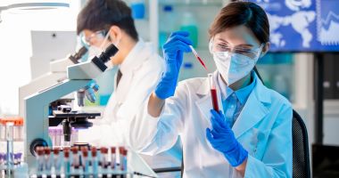 Ureea serică, o analiză necesară pentru a evalua starea de sănătate a rinichilor - 2