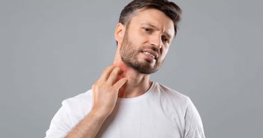 Stire din Sănătate : Atunci când este frig, urticaria poate determina scăderea tensiunii arteriale