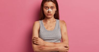 Stire din Sănătate : Cauze frecvente ale apariţiei vânătăilor