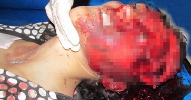 IMAGINI ȘOCANTE! Carnagiu din cauza vitezei. Patru tineri și-au găsit sfârșitul la peste 200 km/h - 5