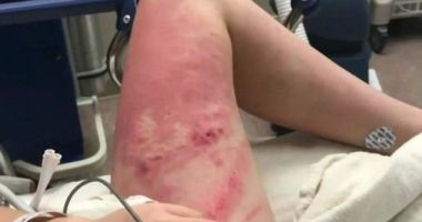 VIDEO ȘOCANT! O fată a fost împinsă în apă de o "prietenă" și a fost la un pas să rămână paralizată - 2