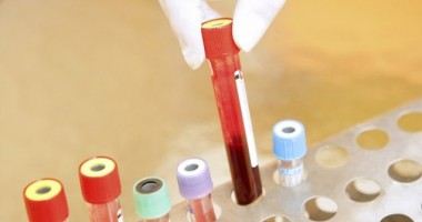 Stire din Sănătate : Anunțul medicilor cu privire la starea românului bolnav de malarie