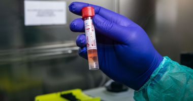 Un bărbat, confirmat cu coronavirus, a intrat în contact cu 150 de persoane înainte de a fi diagnosticat