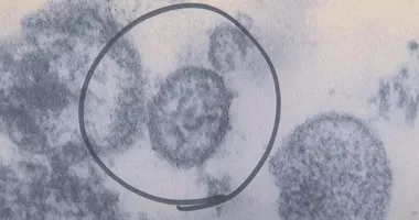 Stire din Actualitate : Focar misterios la bordul unei nave de croazieră. Trei morți și mai multe cazuri suspecte de virus periculos
