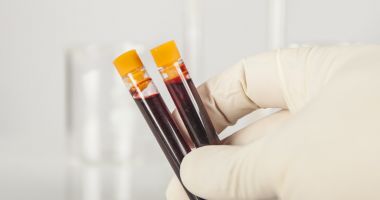 Stire din Social : Peste 800 de pacienți HIV-pozitivi testați pentru boli hepatice, într-un proiect-pilot la Constanța
