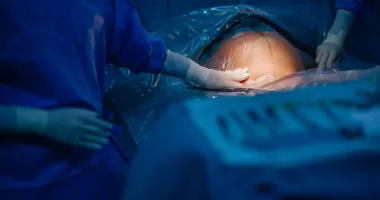 Turcia sancționează peste 100 de medici pentru cezariene nejustificate